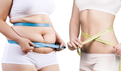 How Gastric Sleeve Surgery Can Transform Health And Quality Of Life?