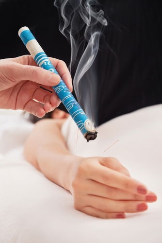 Moxibustion