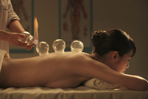 Cupping & Gua sha