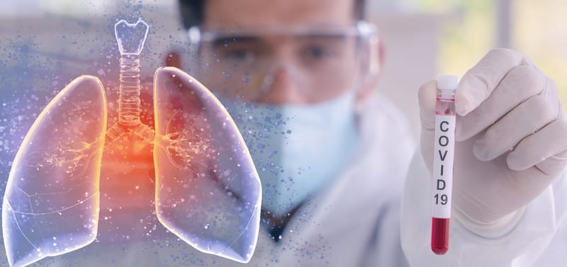 Por encima de hipertensión y diabetes, COVID-19 se estaría perfilando como principal factor de mortalidad en Torreón al finalizar 2020