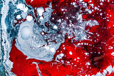 Infection with the common Epstein-Barr virus and MS