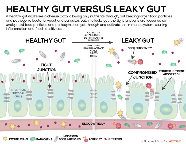 The Cure for MS explained (the complete version).