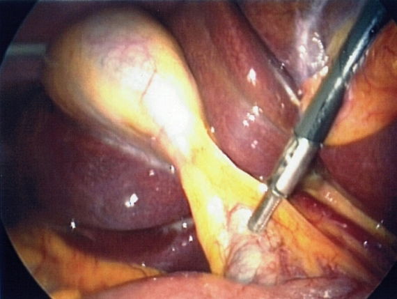 Cirugia de Urgencia