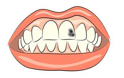 Protez Uygulanmış Hastalarda Diş Tedavisi