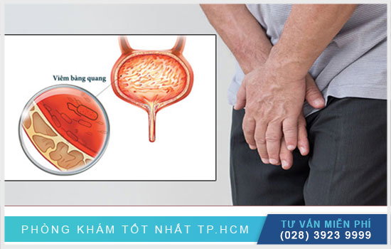 Bệnh viêm bàng quang chữa như thế nào?