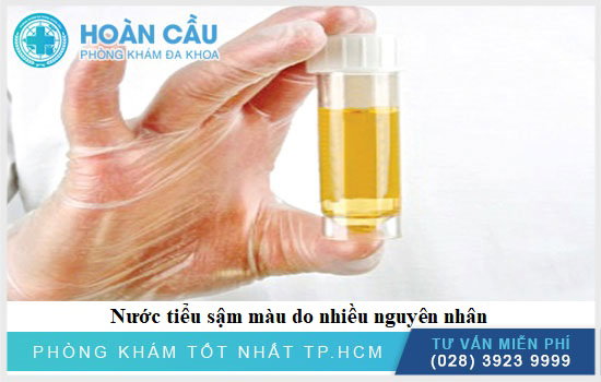 Nước tiểu màu vàng đậm là do đâu?