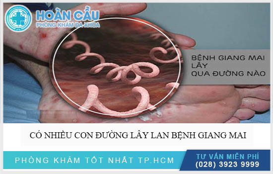 Bệnh Giang mai lây như thế nào?