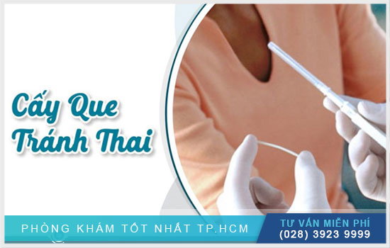 Việc cấy que tránh thai có hiệu quả không?