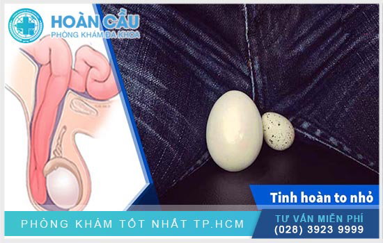 Do đâu lại bị tinh hoàn bên to bên nhỏ?