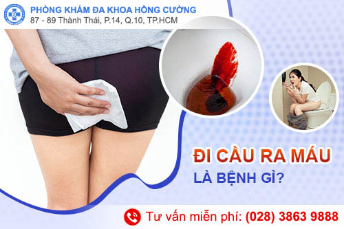 Hiện tượng đi cầu ra máu cần chú ý