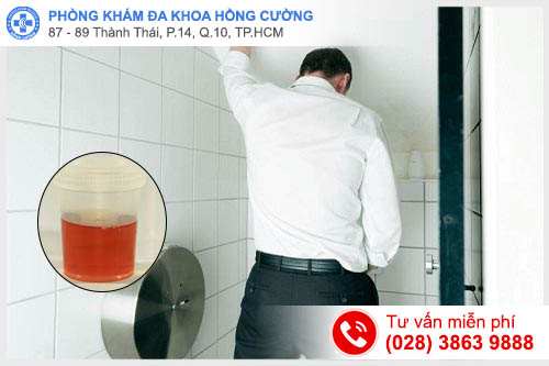 Phòng khám Hồng Cường - Chú ý khi tiểu thấy đau
