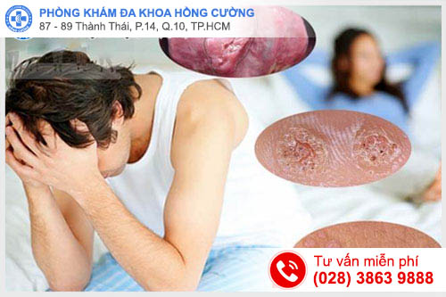Đa khoa Hồng Cường - Phương pháp chữa sùi mào gà hiện nay
