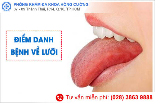 Hồng Cường tổng hợp các bệnh về lưỡi