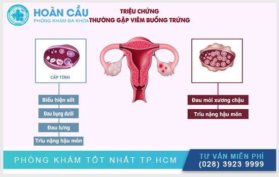 Làm sao nhận biết bị viêm buồng trứng?