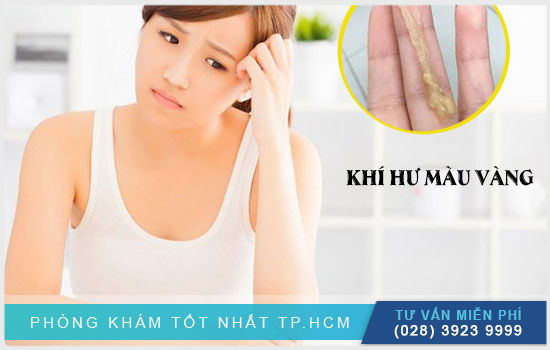 Vì sao lại ra khí hư màu vàng?