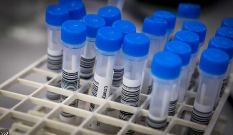 Bundesrat weitet die Teststrategie aus