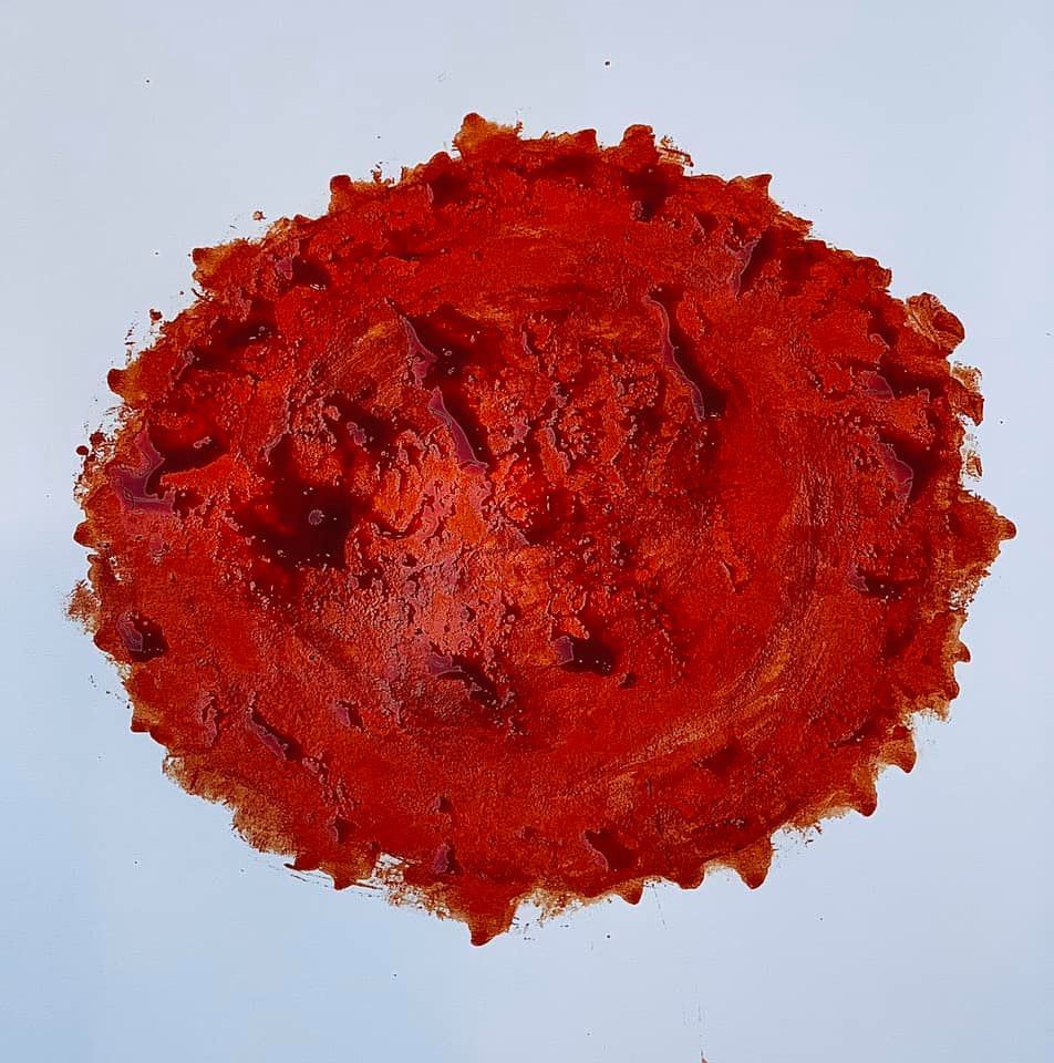 “Covid-19 in Erythrocytes” - Shane Balkowitsch