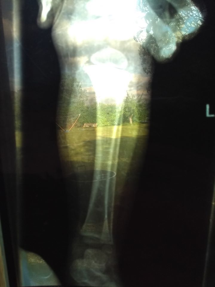 Baby leg x-ray with garden view - Deborah Burton