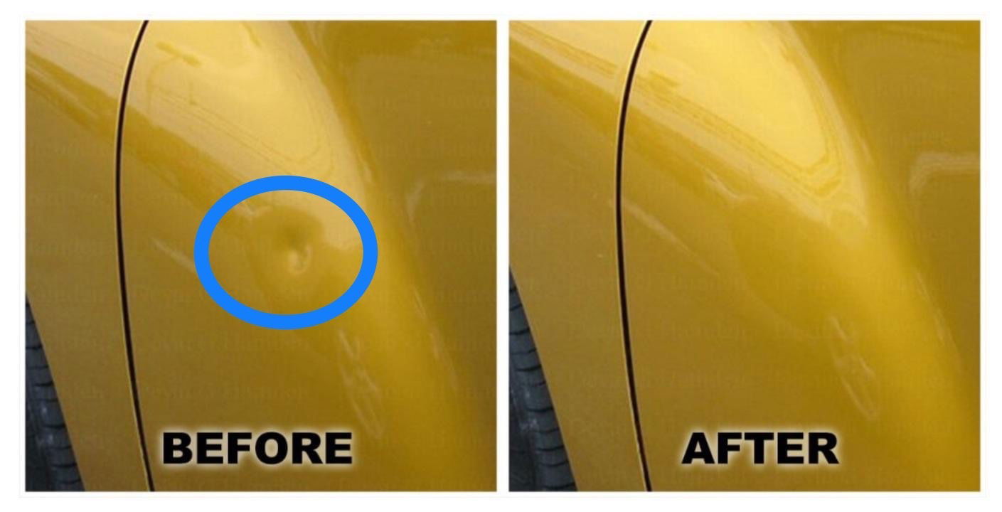 Paintless Dent Removal