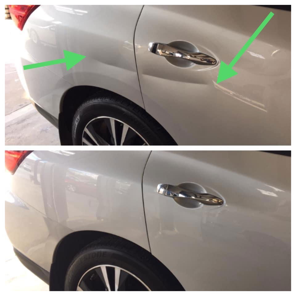 Paintless Dent Removal