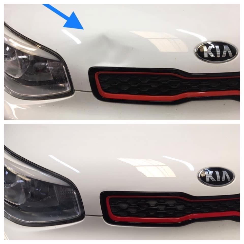 Paintless Dent Removal