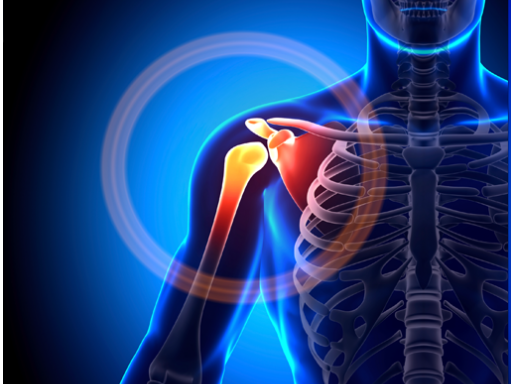 Rotator Cuff Surgery