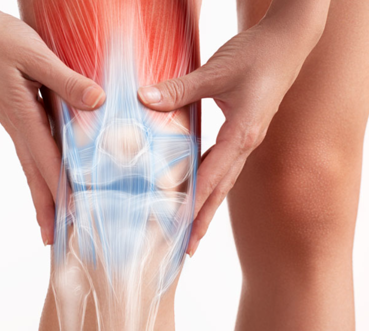 Knee Replacement
