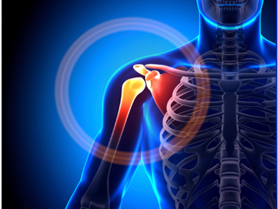 Rotator Cuff Surgery