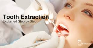 Extractions