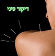 דיקור סיני