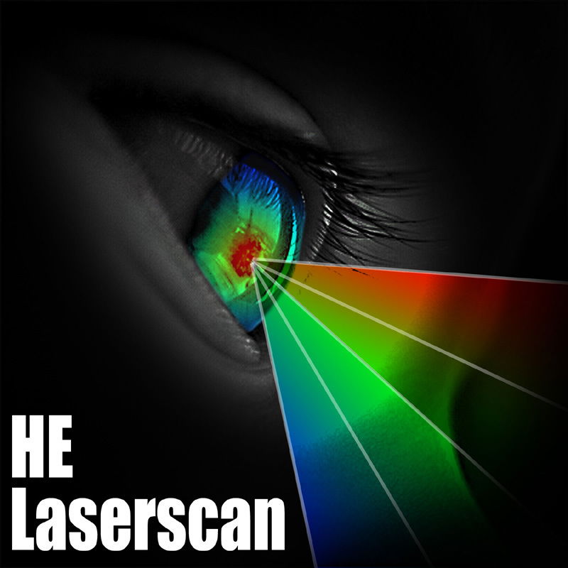 HE-Laserscan