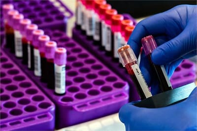 Big news: native vaccine will soon start testing on humans