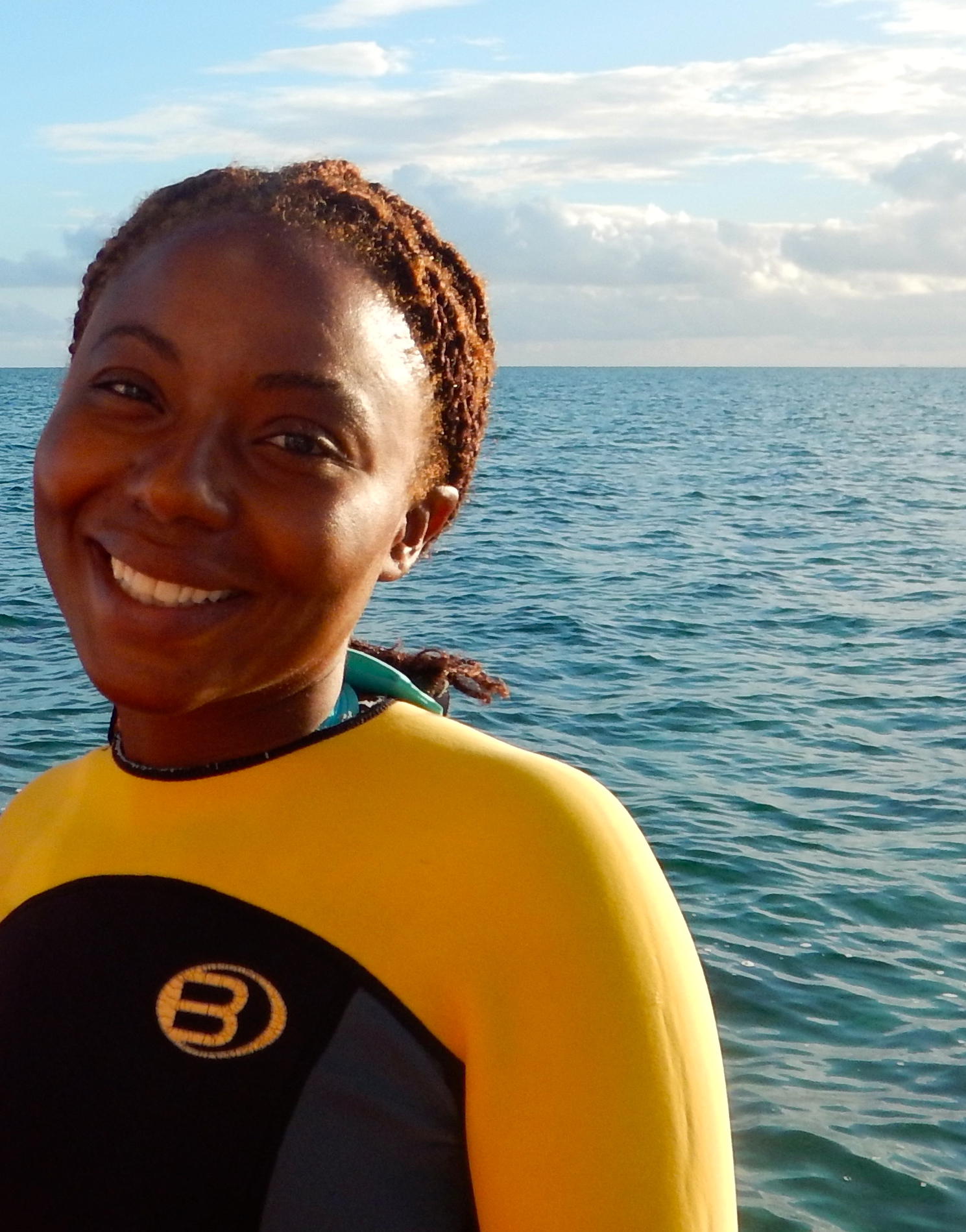 What's it like to be stung by a lionfish?