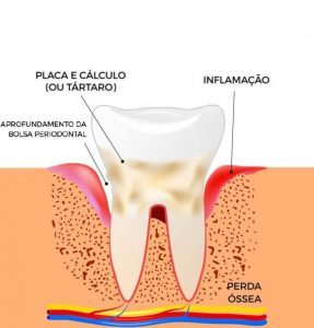 Periodontia