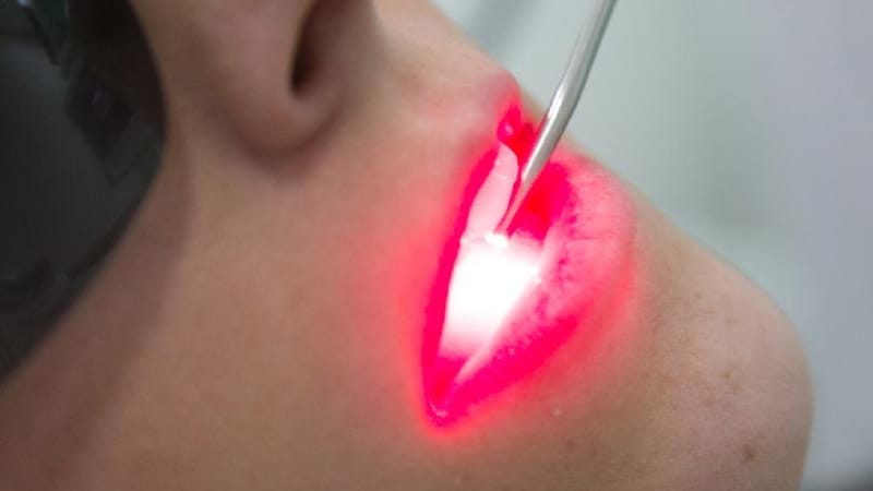 Laserterapia