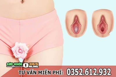 Va mang trinh bao nhieu tien