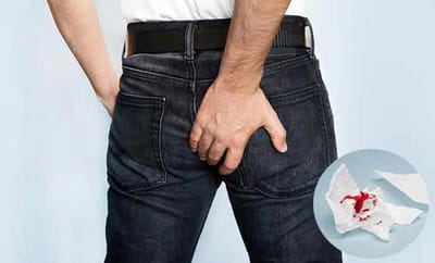 Benh tri co chua khoi khong