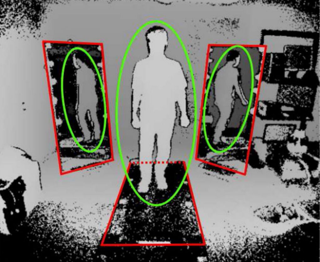 Estimation of gait normality index based on point clouds through deep auto-encoder