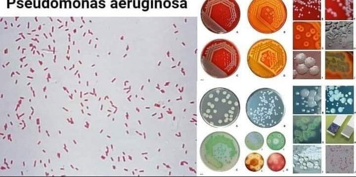 الزائفة الزنجارية(عصيات القيح الأزرق) Pseudomonas aeruginosa