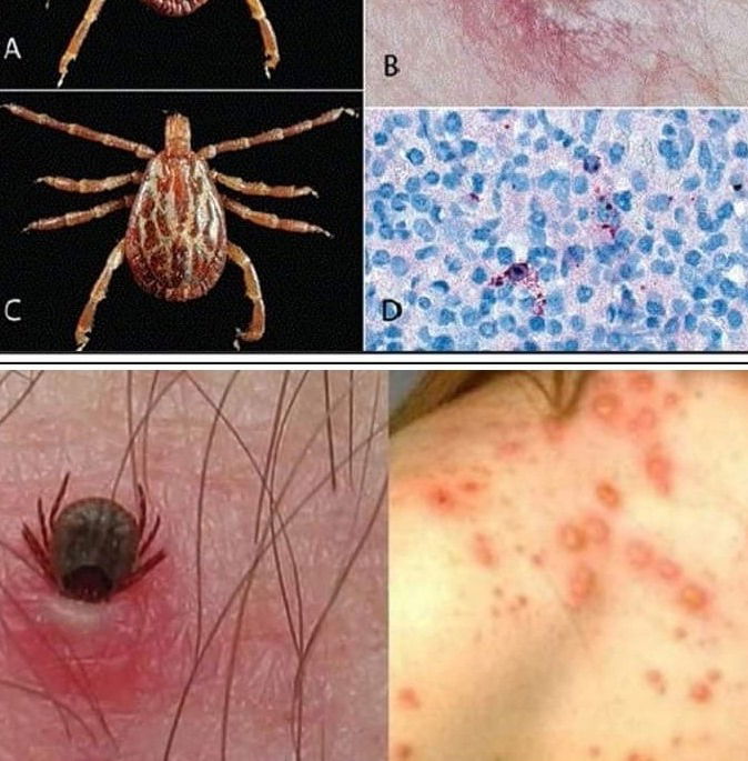 جرَاثِيم الرِّيكِتْسِيَّة Rickettsia