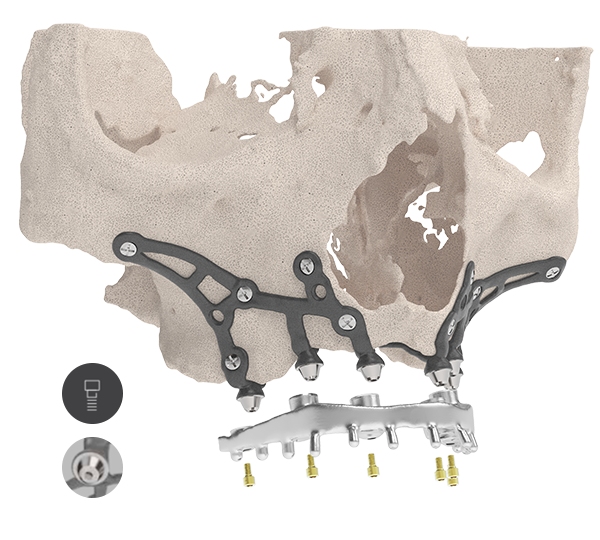 Inteligenty implant IUXTA3D