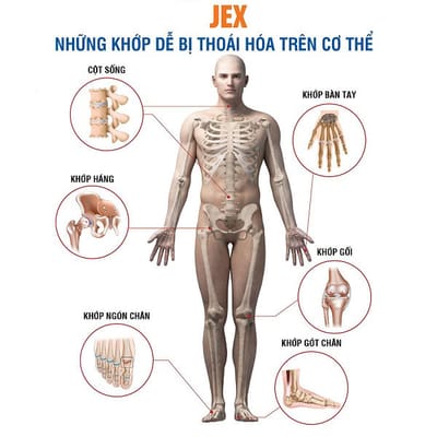 Nguyen nhan gay thoai hoa khop