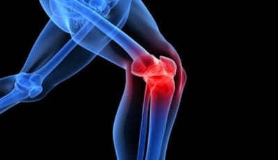 7 dau hieu viem khop goi thuong gap