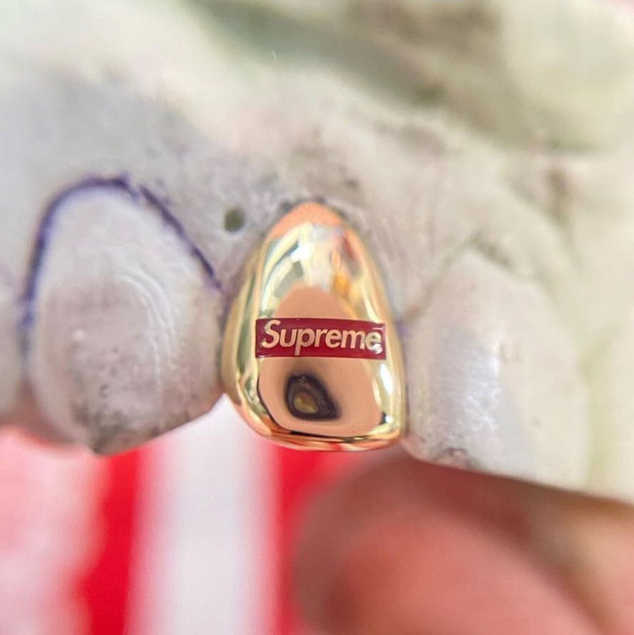 牙飾藝術家 AKIYAMA 為 SUPREME 涉谷店店長打造獨一無二 SUPREME 金牙