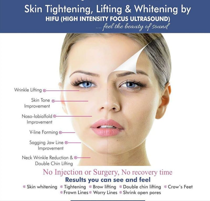 3DHIFU FACE & NECK LIFT & Skin Tightening