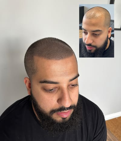 How does it heal ? image