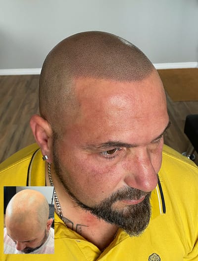 Does it Hurt ? image