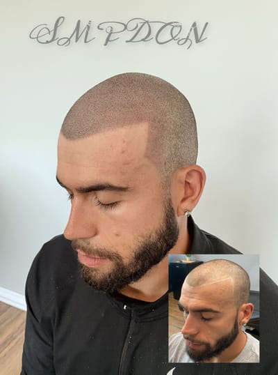 Does it Hurt ? image