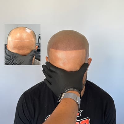 What&#039;s SMP ? image