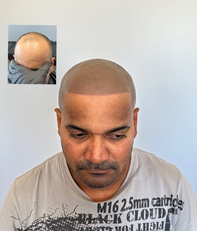 What&#039;s SMP ? image